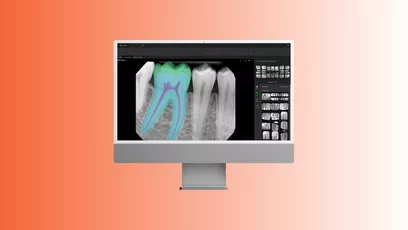 DEXIS AI Diagnostics Module 2D AI Software Findings