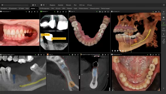 DTX Studio Clinic: The future of imaging starts here