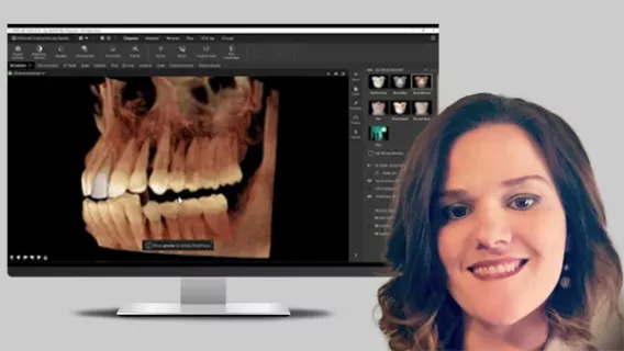 Exploring DTX Studio™ Clinic: Dynamic Design in Action