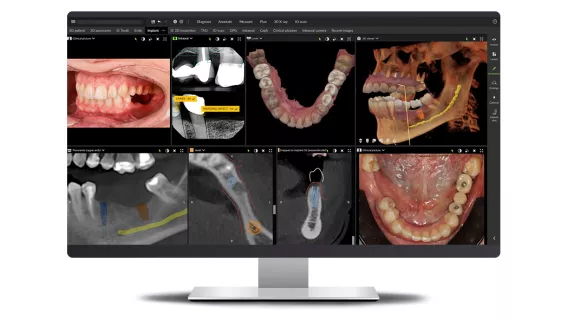 DTX Studio Clinic: Seeing the full picture down to the finest details.