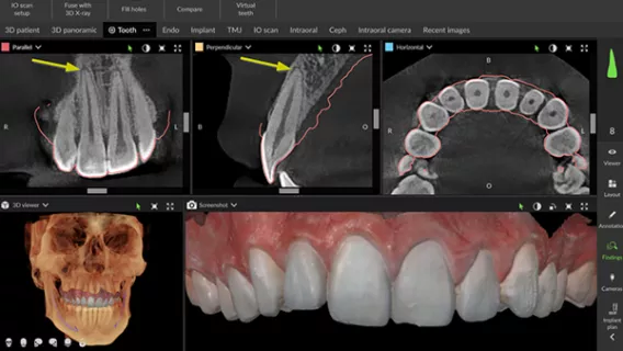 Think 3D: How to Read a CBCT Scan
