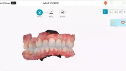 Orthodontic simulation