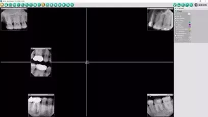 DEXIS Imaging Suite v10 with DEXassist