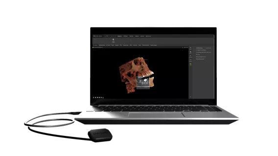 DEXIS launches DEXIS Connect Pro