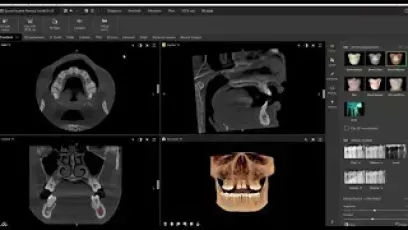 Featuring MagicAssist IOS + 3D fusion - DTX Studio Clinic