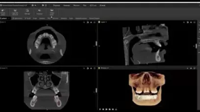Featuring MagicAssist virtual crown creation - DTX Studio Clinic