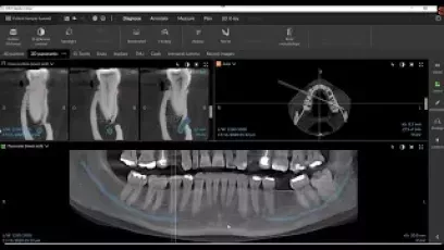 Featuring MagicAssist nerve mapping - DTX Studio Clinic