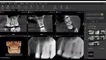 Featuring MagicSort and AI 2D Dental Findings - DTX Studio™ Clinic