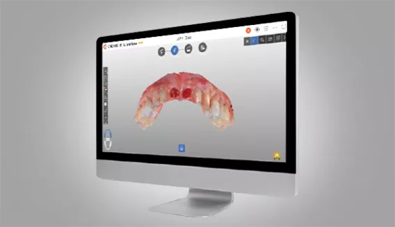 DEXIS™ IS ScanFlow