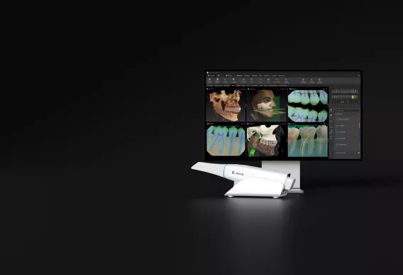 Transforming Dentistry with  a Scan‑to‑Plan Workflow