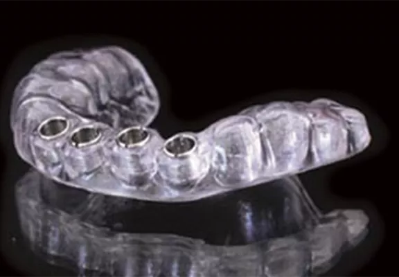 Accurate Implant Placement with Surgical Guides