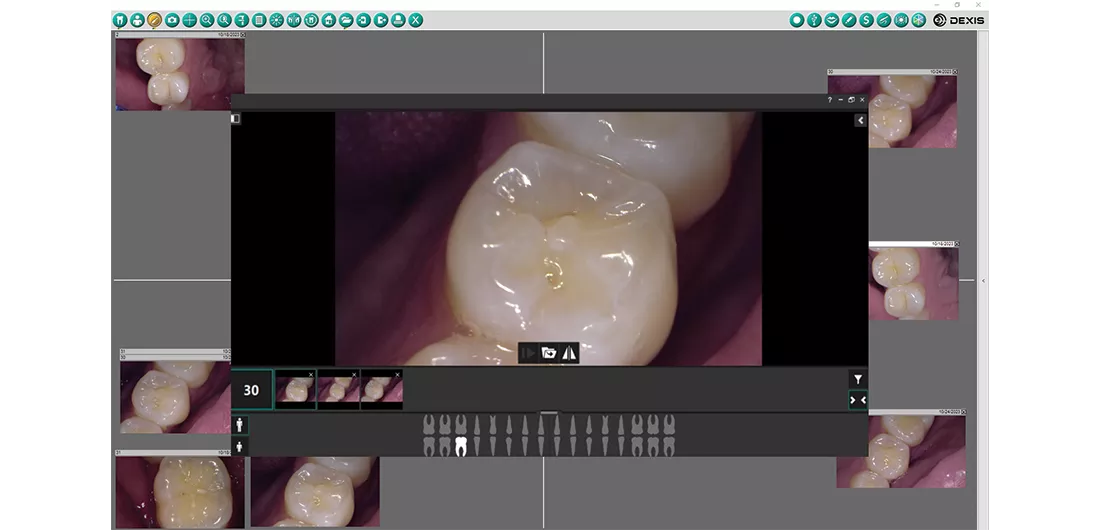 DEXcapture2