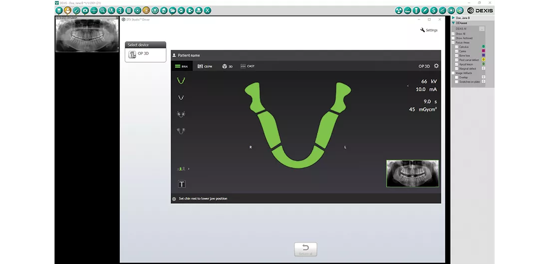 DEXview 3D
