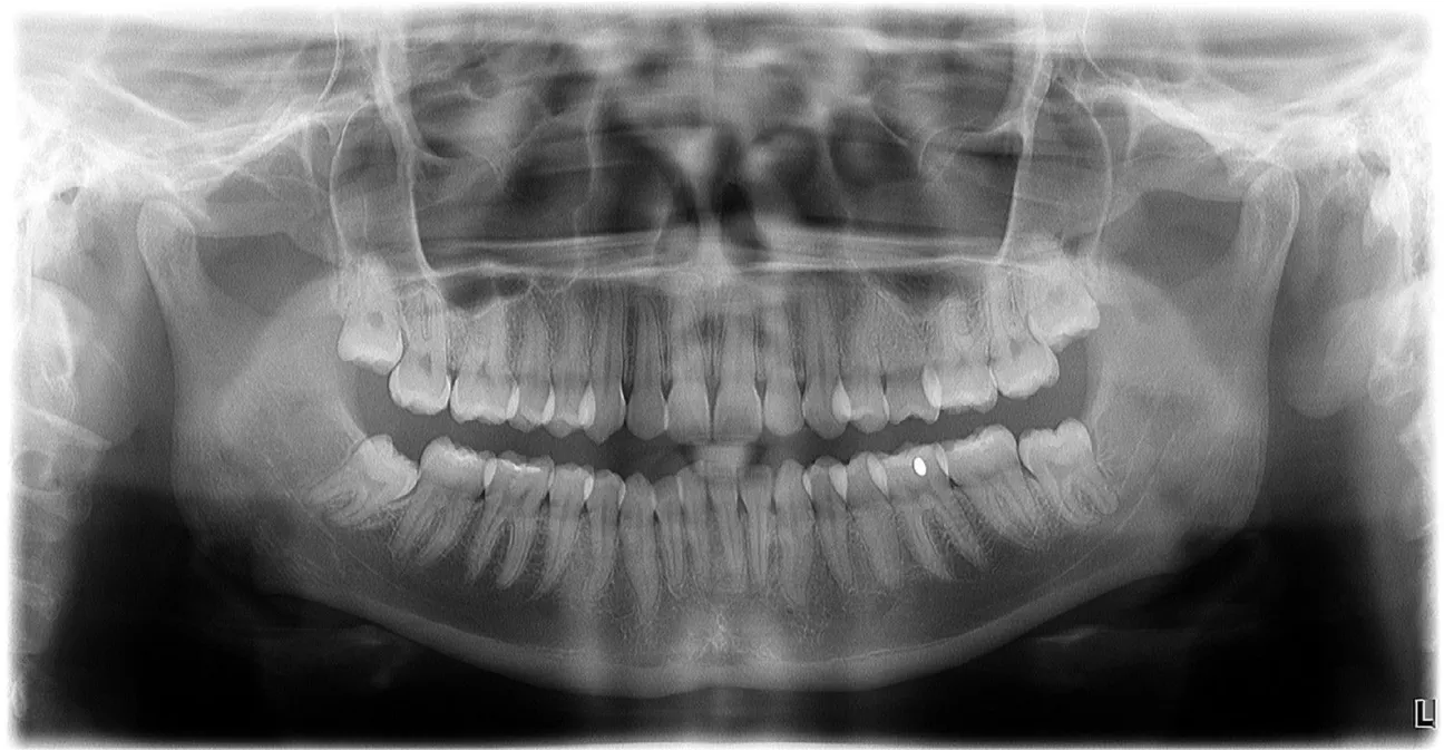 OP-3D Ceph X-ray Panoramic Standard