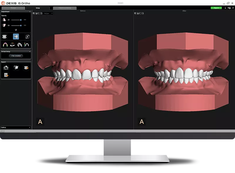 DEXIS IS Ortho