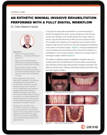Dr Saratti - An esthetic minimal invasive rehabilitation performed with a fully digital workflow
