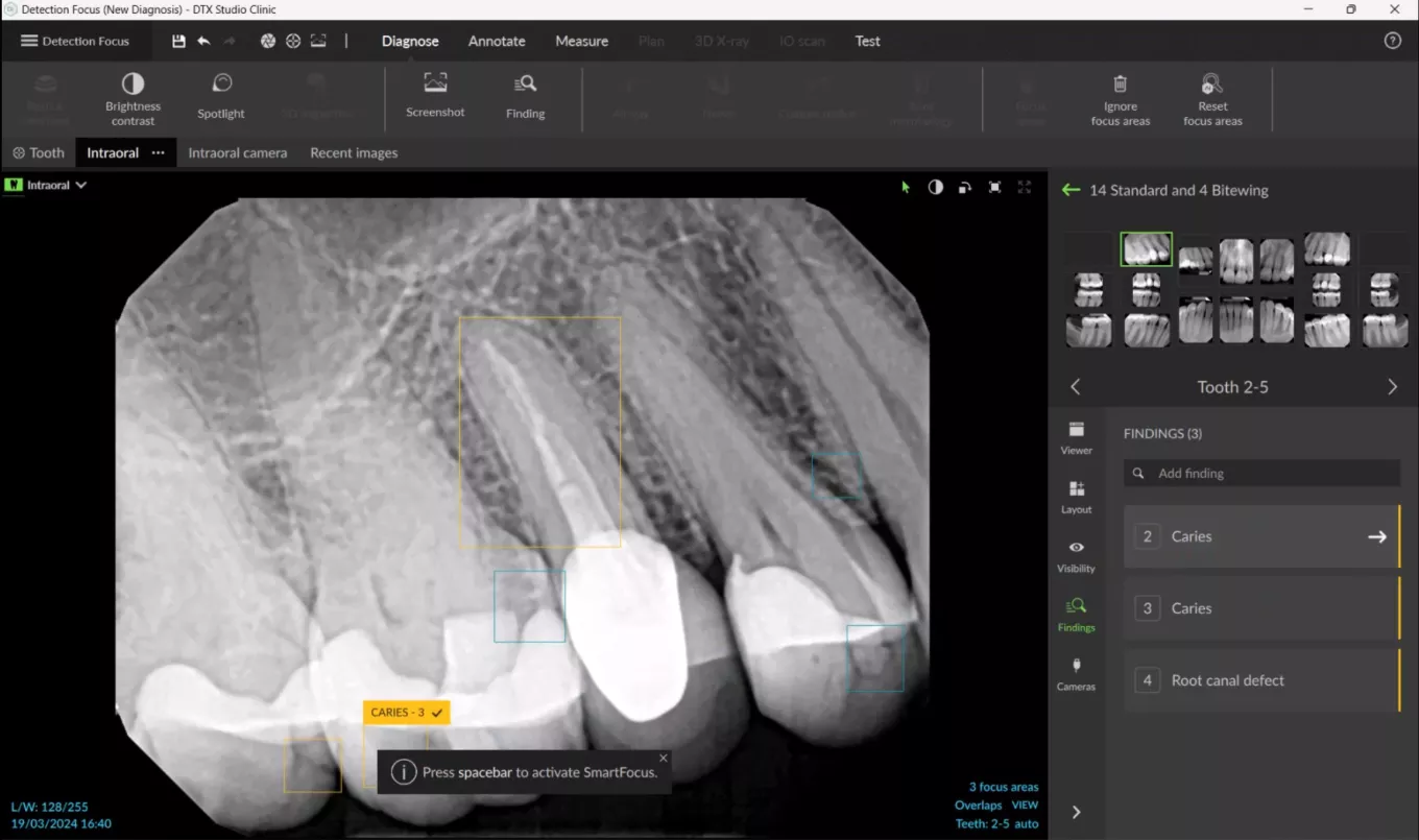 identifies up to 6 common dental findings