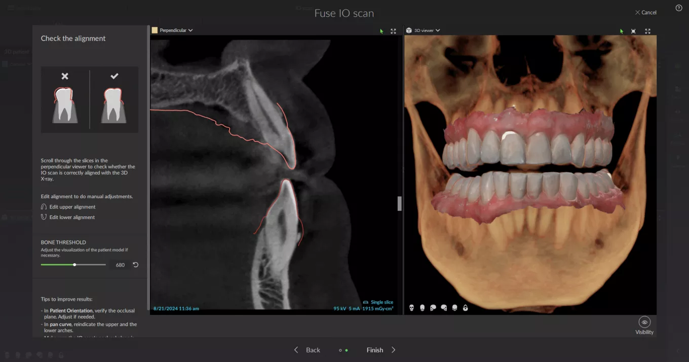 identifies tooth numbers on IOS