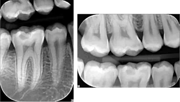 kavo focus intraoral