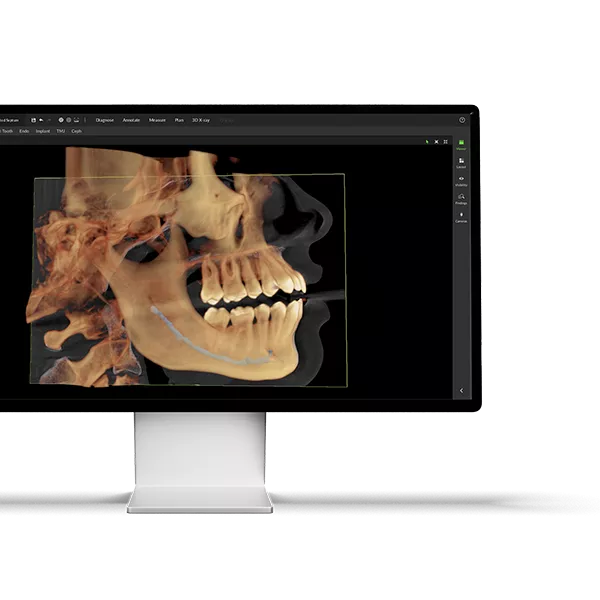 Monitor OP3D EX