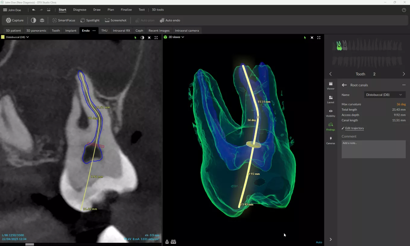 DTX 4.10_Endo_canal-mapping