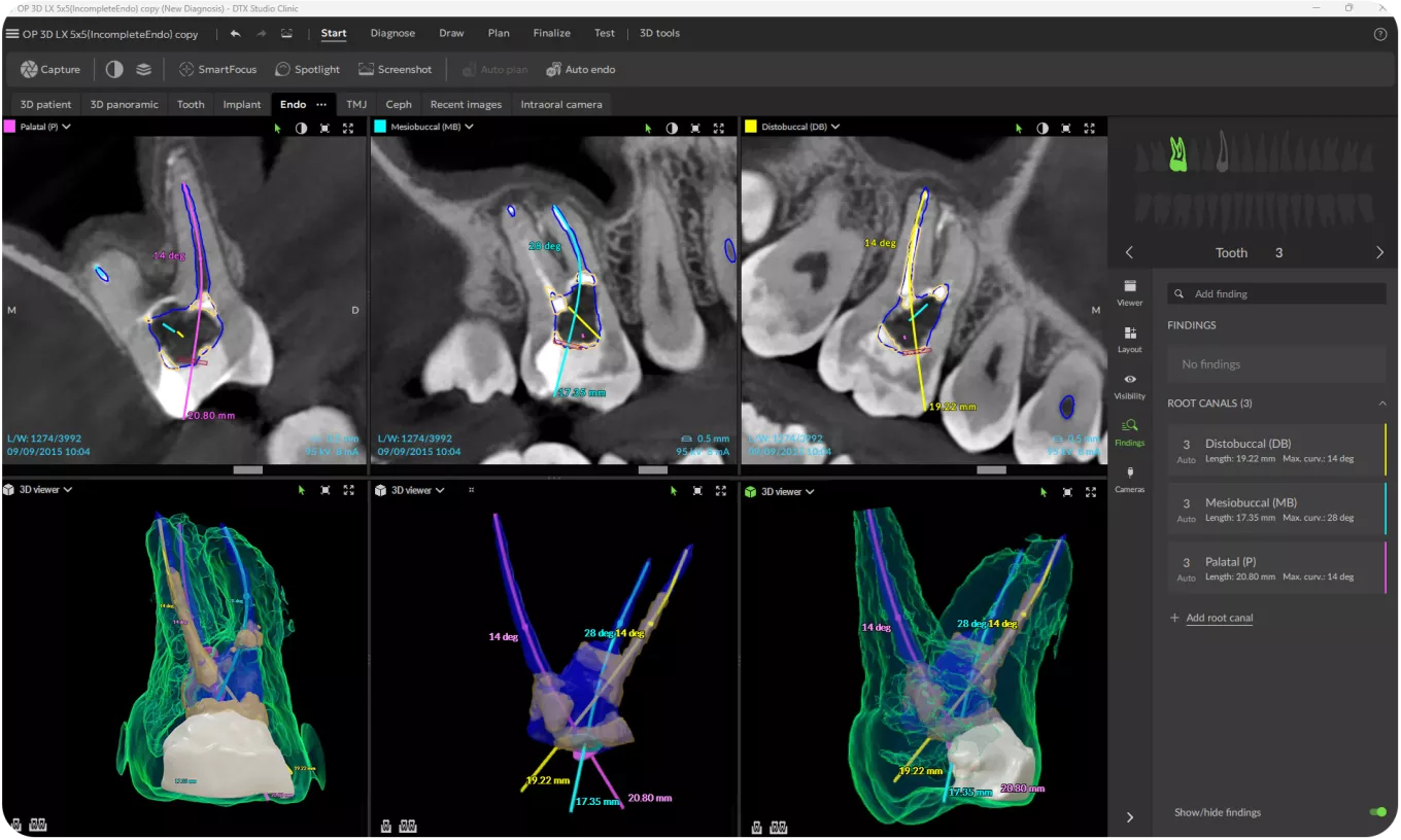 transform CBCT scans