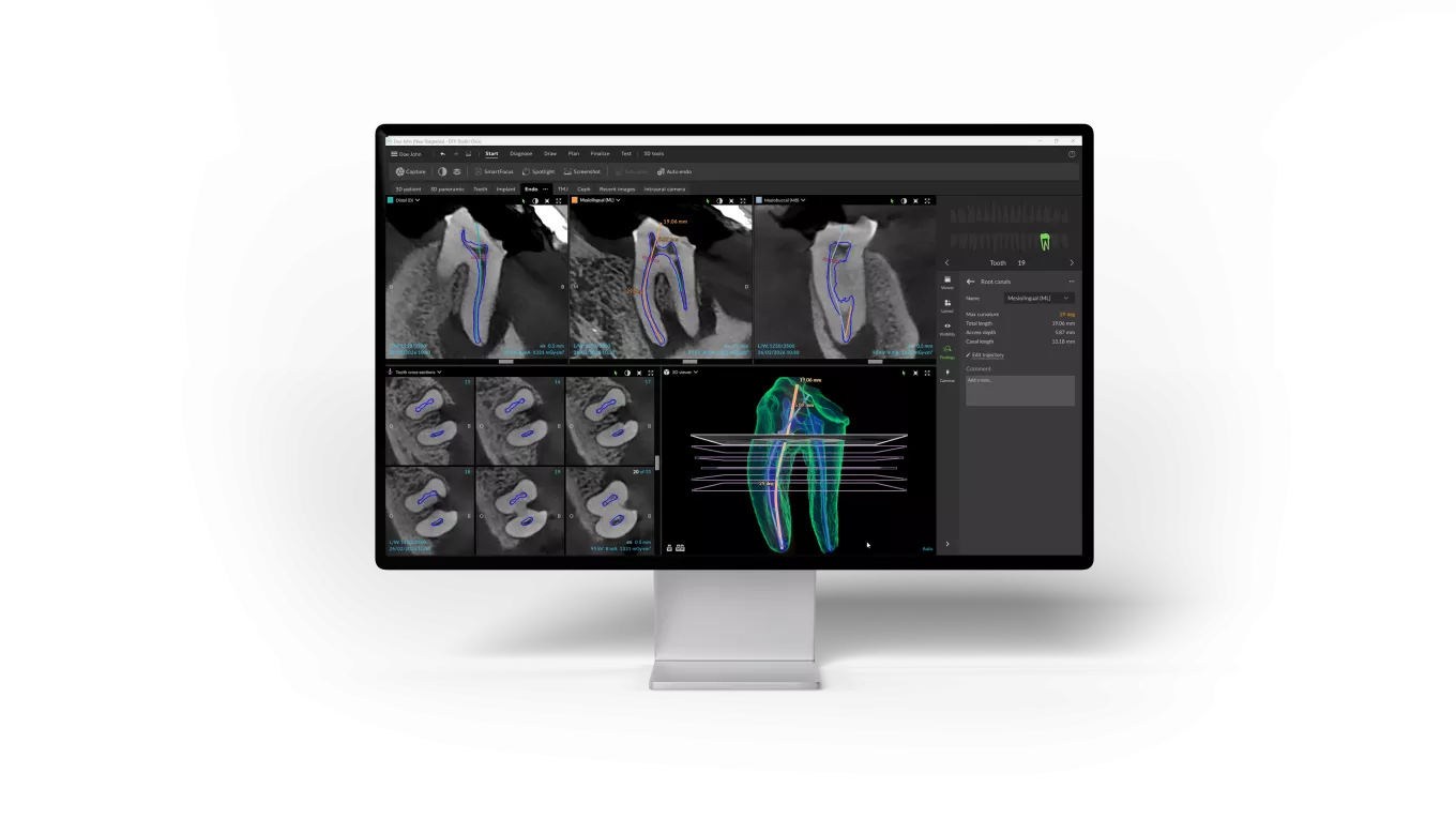 DTX 4.10_EndoScreen