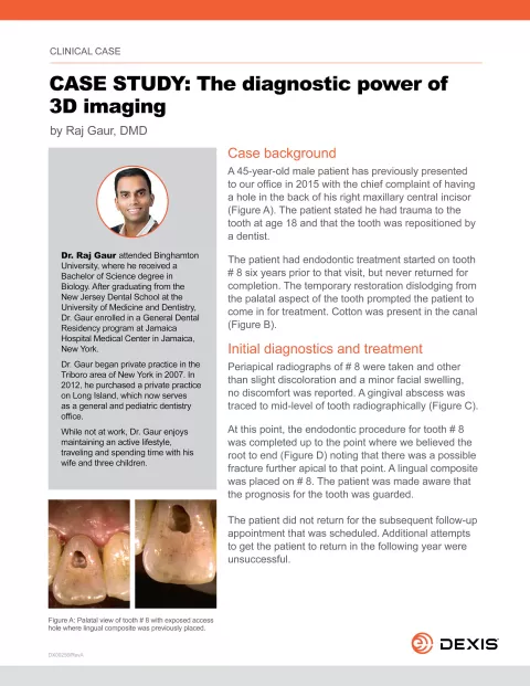 DX00256_RevA-Dr. Raj Gaur Case Study_EN